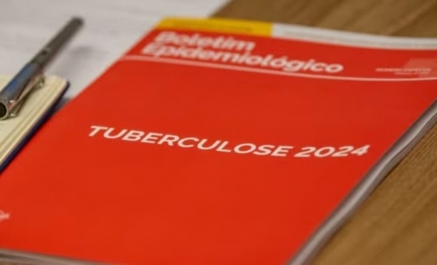 Brasil registra mais de 80 mil novos casos de tuberculose em 2023, aponta boletim epidemiolgico