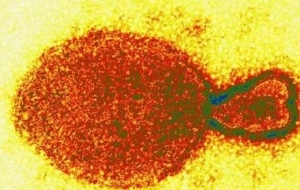 Cientistas chineses identificam novo vírus em humanos: 'Langya henipavirus'