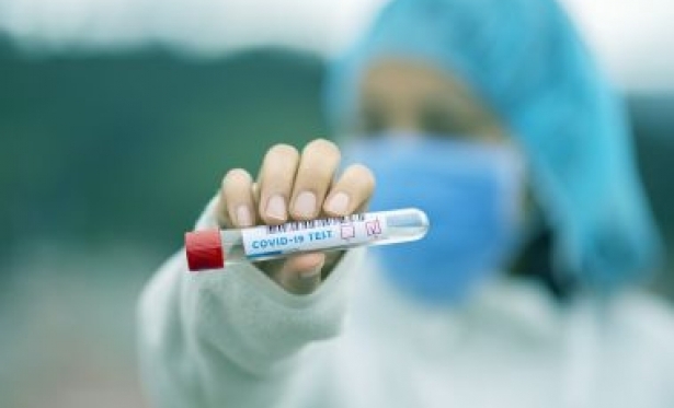 Ministério da Saúde reduz quarentena de infectados da Covid com quadro leve para 7 dias